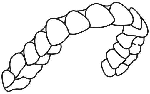 Aligner oben